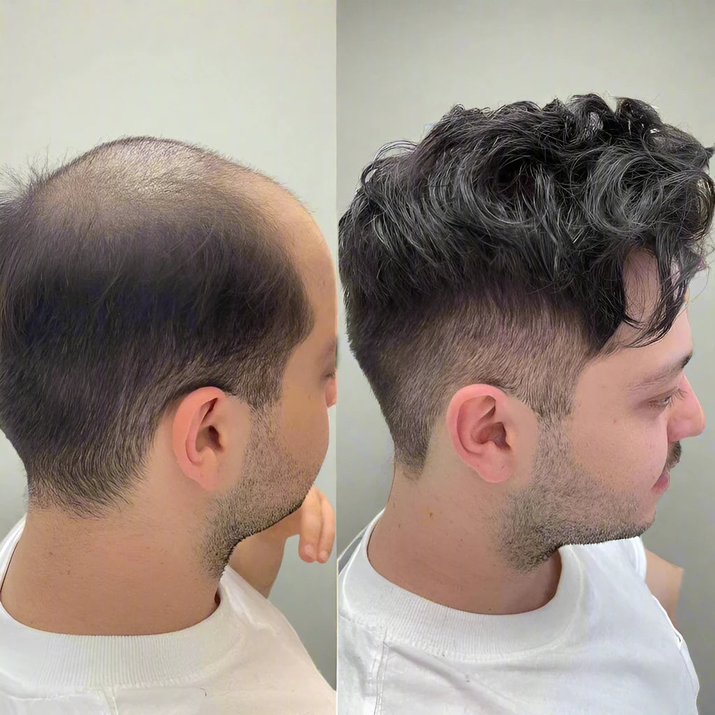 Toupee For Men Lace Frontal